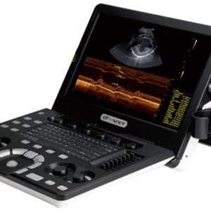 Φορητός Υπέρηχος D2